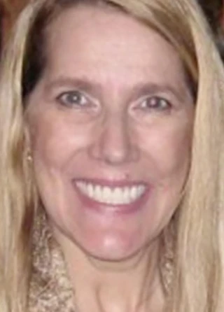 Pam Reynolds