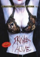 Skinned Alive