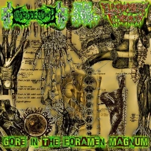 Gore In the Foramen Magnum