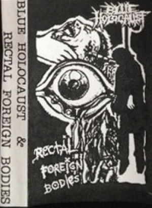 Blue Holocaust & Rectal Foreign Bodies