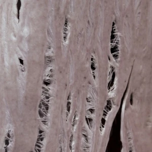 Torn