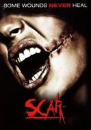 Scar