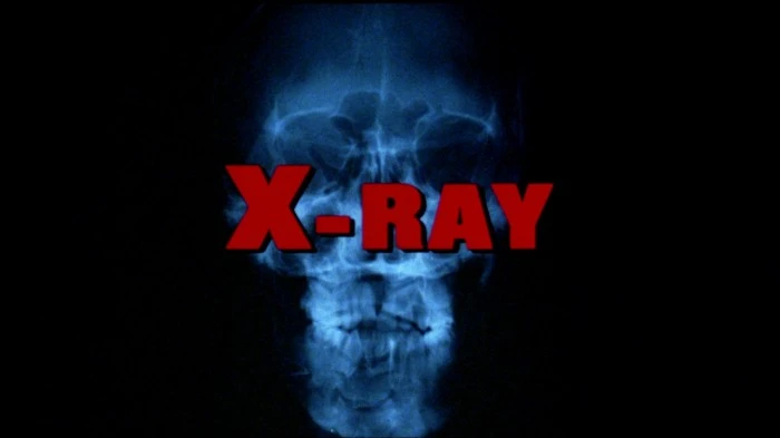 Title Card