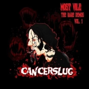 Most Vile: The Rare Demos, Volume 1
