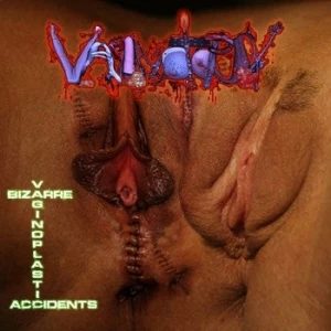 Bizarre Vaginoplastic Accidents