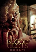 Blood Clots