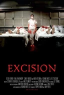 Excision