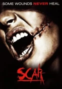 Scar