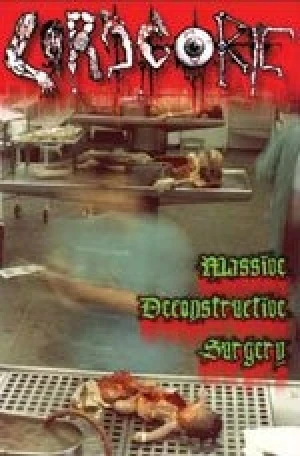 Massive Deconstructive Surgery